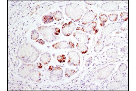 undefined Image 7: PhosphoPlus<sup>®</sup> Notch1 (Cleaved, Val1744) Antibody Duet