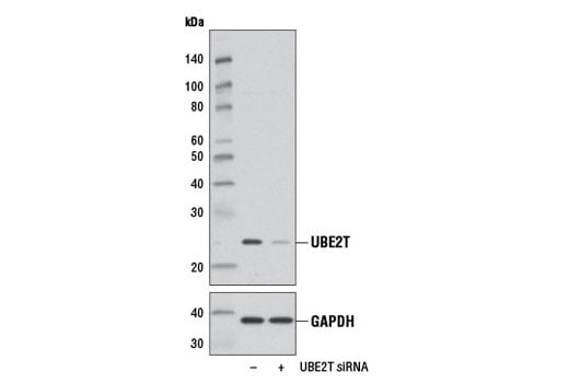 Western Blotting Image 3: UBE2T (D2L7H) Rabbit mAb