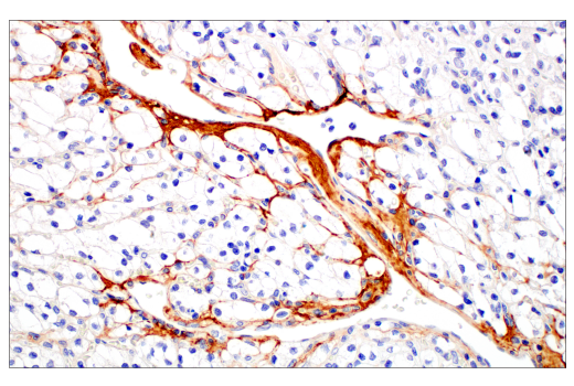 undefined Image 31: Extracellular Matrix Dynamics Antibody Sampler Kit