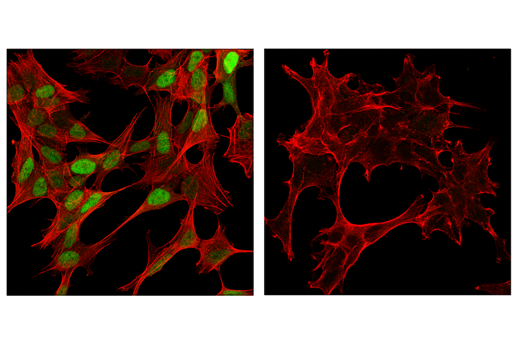 Immunofluorescence Image 1: Cyclin D1 (E3P5S) XP<sup>®</sup> Rabbit mAb