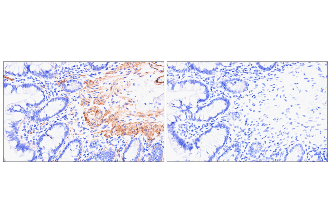 MYH11 (E4N8M) Rabbit mAb (BSA and Azide Free) | Cell