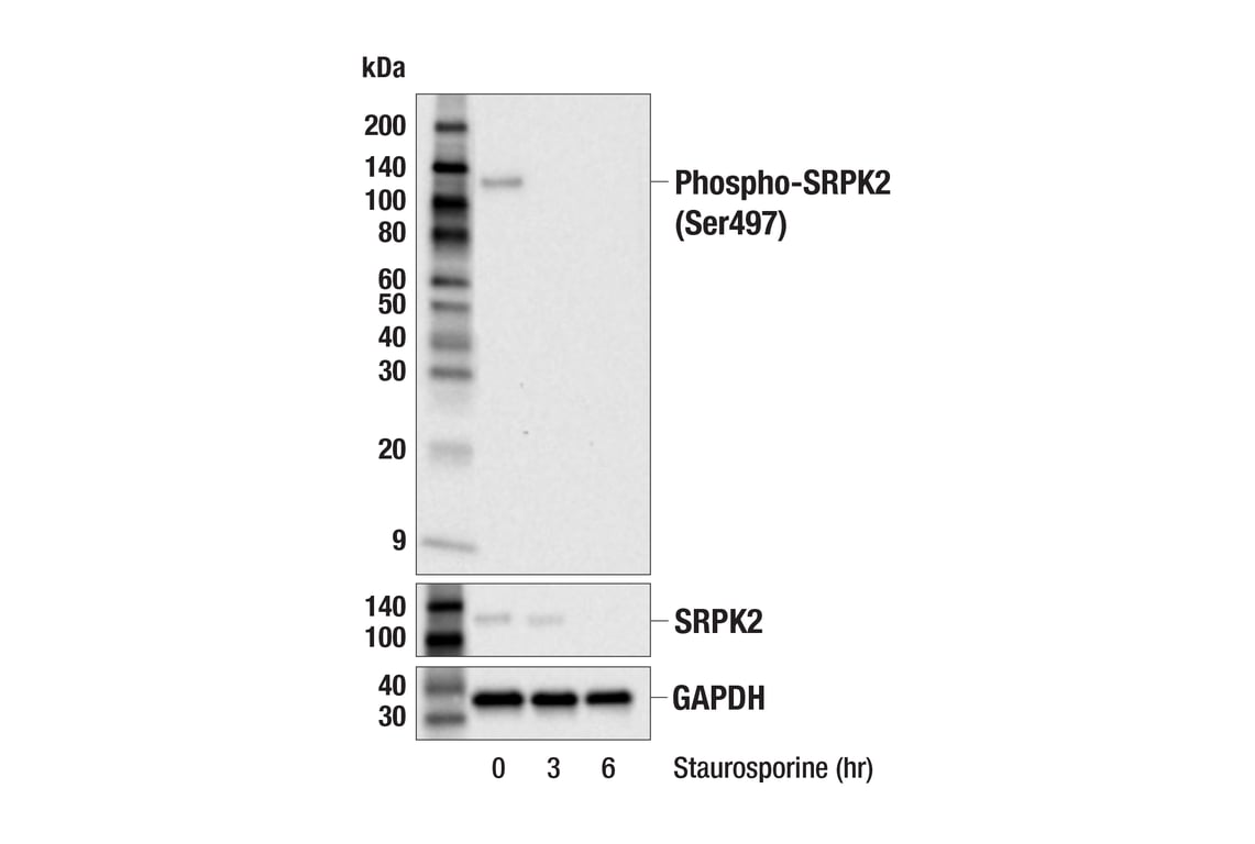 Western Blotting Image 2: Phospho-SRPK2 (Ser497) (E5T6B) Rabbit mAb