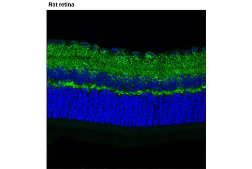 Immunofluorescence Image 1: AMPA Receptor 4 (GluA 4) (D41A11) XP<sup>®</sup> Rabbit mAb