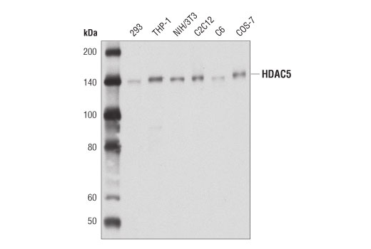 Western Blotting Image 1: HDAC5 (D1J7V) Rabbit mAb