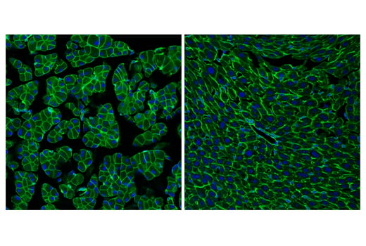 Immunofluorescence Image 1: Ras (E4K9L) Rabbit mAb