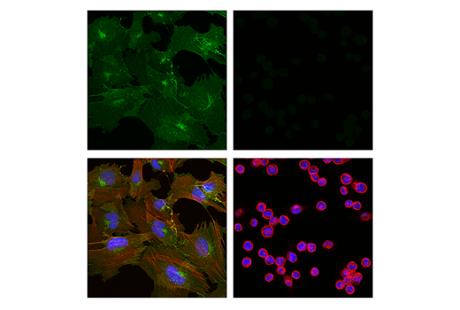 Immunofluorescence Image 1: CD248 (E9Z7O) XP<sup>®</sup> Rabbit mAb