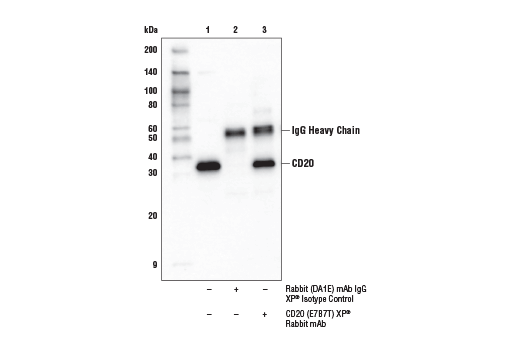 Immunoprecipitation Image 1: CD20 (E7B7T) XP<sup>®</sup> Rabbit mAb