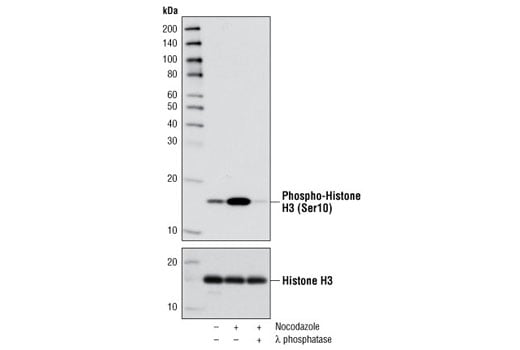 undefined Image 1: PhosphoPlus<sup>®</sup> Histone H3 (Ser10) Antibody Duet