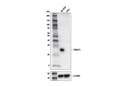 Western Blotting Image 1: TWIST1 (E7E2G) Rabbit mAb