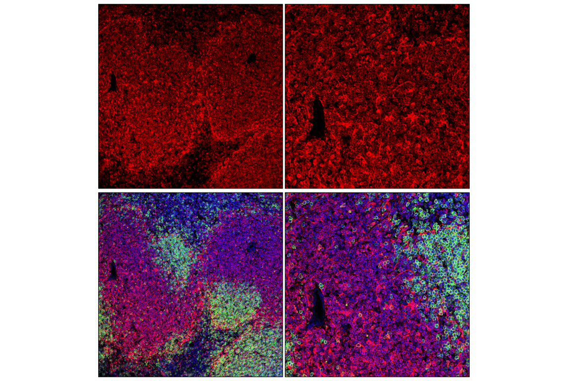 Immunofluorescence Image 3: STING (E9X7F) Rabbit mAb