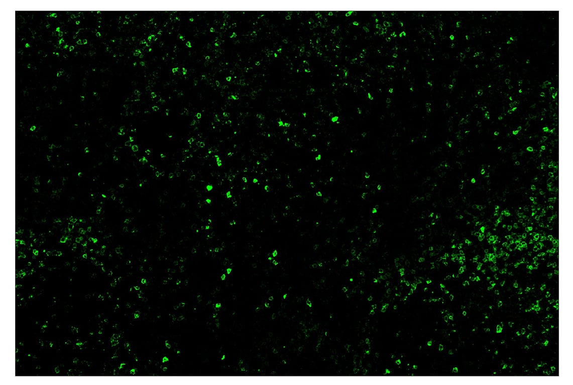 Immunohistochemistry Image 2: LAG3 (D2G4O<sup>™</sup>) & CO-0026-647 SignalStar<sup>™</sup> Oligo-Antibody Pair