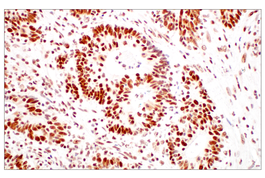 Immunohistochemistry Image 1: METTL3 (E3F2A) Rabbit mAb (BSA and Azide Free)