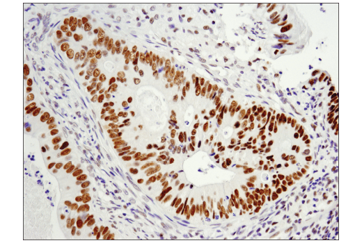 Immunohistochemistry Image 1: LRF/Pokemon (D7U2O) Rabbit mAb