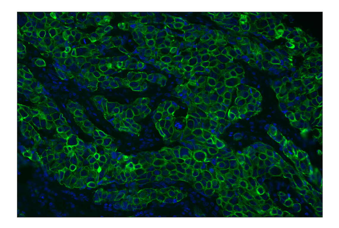 Immunohistochemistry Image 3: Pan-Keratin (Type I) (E6S1S) Rabbit mAb (Alexa Fluor<sup>®</sup> 488 Conjugate)