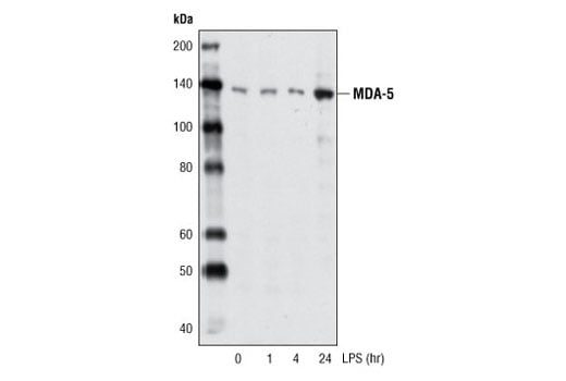 Western Blotting Image 2: MDA-5 (D74E4) Rabbit mAb