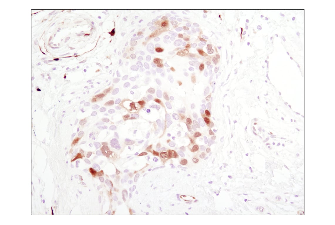 undefined Image 40: Cannabinoid Receptor 1 Downstream Signaling Antibody Sampler Kit