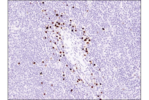 Immunohistochemistry Image 4: MIST1/bHLHa15 (D7N4B) XP<sup>®</sup> Rabbit mAb