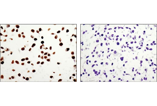 Immunohistochemistry Image 2: DAX1 (D2F1) Rabbit mAb