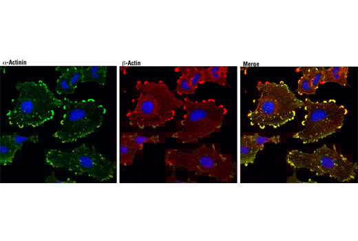 Immunofluorescence Image 1: α-Actinin (D6F6) XP<sup>®</sup> Rabbit mAb