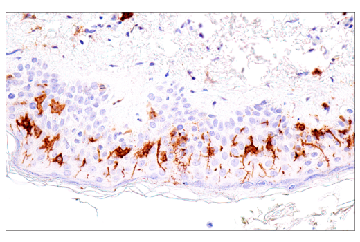 Immunohistochemistry Image 1: CD1A (MTB1) Mouse mAb