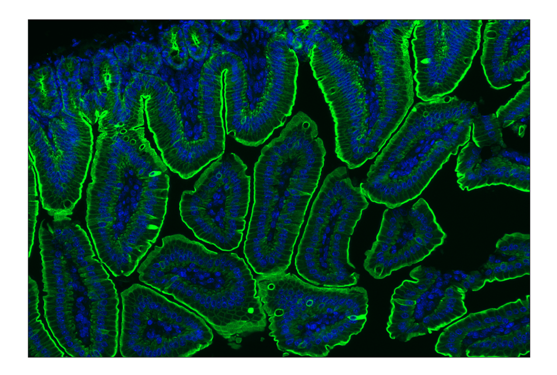 Immunohistochemistry Image 1: Pan-Keratin (Type I) (E6S1S) Rabbit mAb (Alexa Fluor<sup>®</sup> 488 Conjugate)