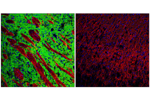 Immunofluorescence Image 1: Dopamine D(1) Receptor/D1R (E3H3S) Rabbit mAb