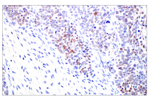 Immunohistochemistry Image 2: C/EBPβ (E2K1U) Rabbit mAb