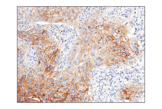 Immunohistochemistry Image 3: CD47 (D3O7P) Rabbit mAb