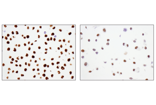 Immunohistochemistry Image 1: ATF-2 (D4L2X) XP<sup>®</sup> Rabbit mAb