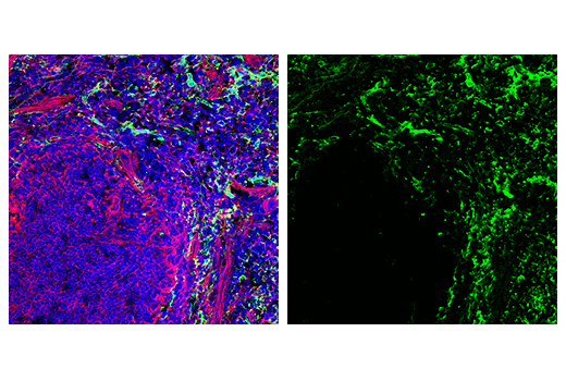 undefined Image 86: Mouse Reactive M1 vs M2 Macrophage IHC Antibody Sampler Kit