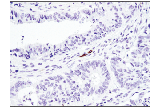 Immunohistochemistry Image 4: TNFRSF8/CD30 (E4L4I) XP<sup>®</sup> Rabbit mAb