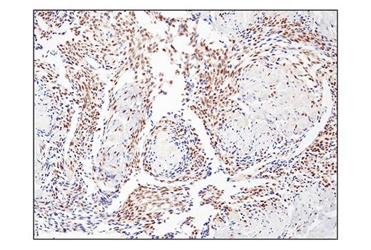 undefined Image 53: BAF Complex IHC Antibody Sampler Kit