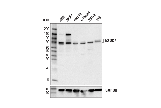 Western Blotting Image 2: EXOC7 (E4W6R) Rabbit mAb