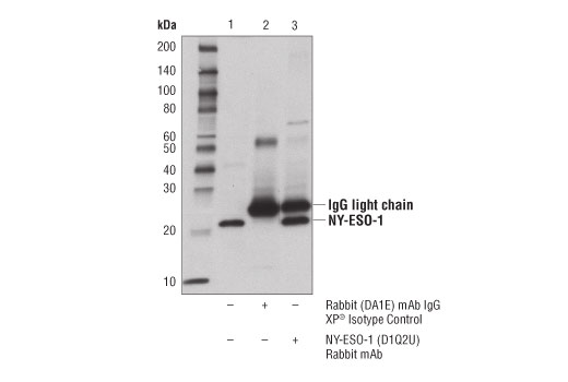 Immunoprecipitation Image 1: NY-ESO-1 (D1Q2U) Rabbit mAb