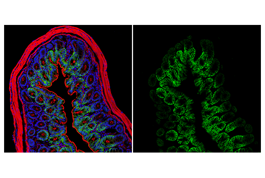 Immunofluorescence Image 2: AQP4 (D1F8E) XP<sup>®</sup> Rabbit mAb (Alexa Fluor<sup>®</sup> 488 Conjugate)