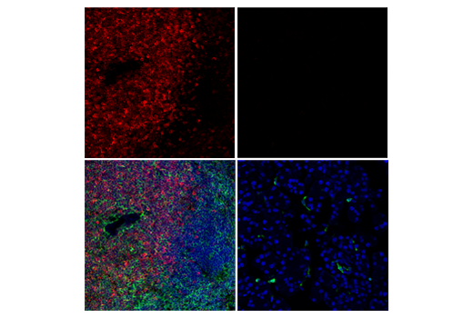 Immunofluorescence Image 1: CD3ε (E4T1B) XP<sup>®</sup> Rabbit mAb (BSA and Azide Free)