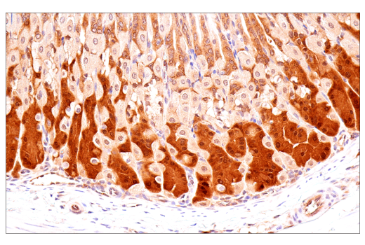 Immunohistochemistry Image 9: p70 S6 Kinase (E8K6T) XP<sup>®</sup> Rabbit mAb