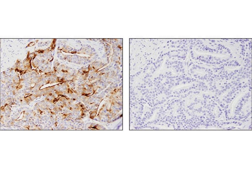 Immunohistochemistry Image 3: Prostate Specific Membrane Antigen (D7I8E) XP<sup>®</sup> Rabbit mAb (BSA and Azide Free)