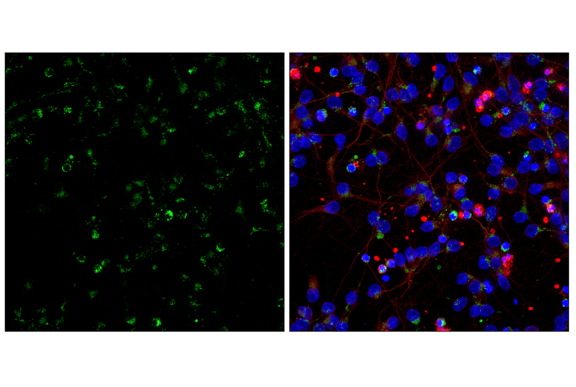 undefined Image 38: PICALM Signaling Antibody Sampler Kit