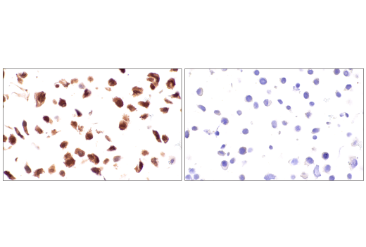 Immunohistochemistry Image 14: p70 S6 Kinase (E8K6T) XP<sup>®</sup> Rabbit mAb