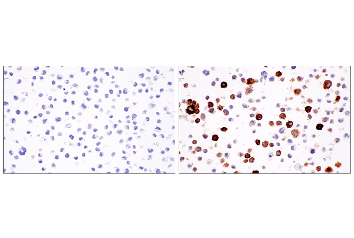 Immunohistochemistry Image 7: IL-8 (E5F5Q) XP<sup>®</sup> Rabbit mAb