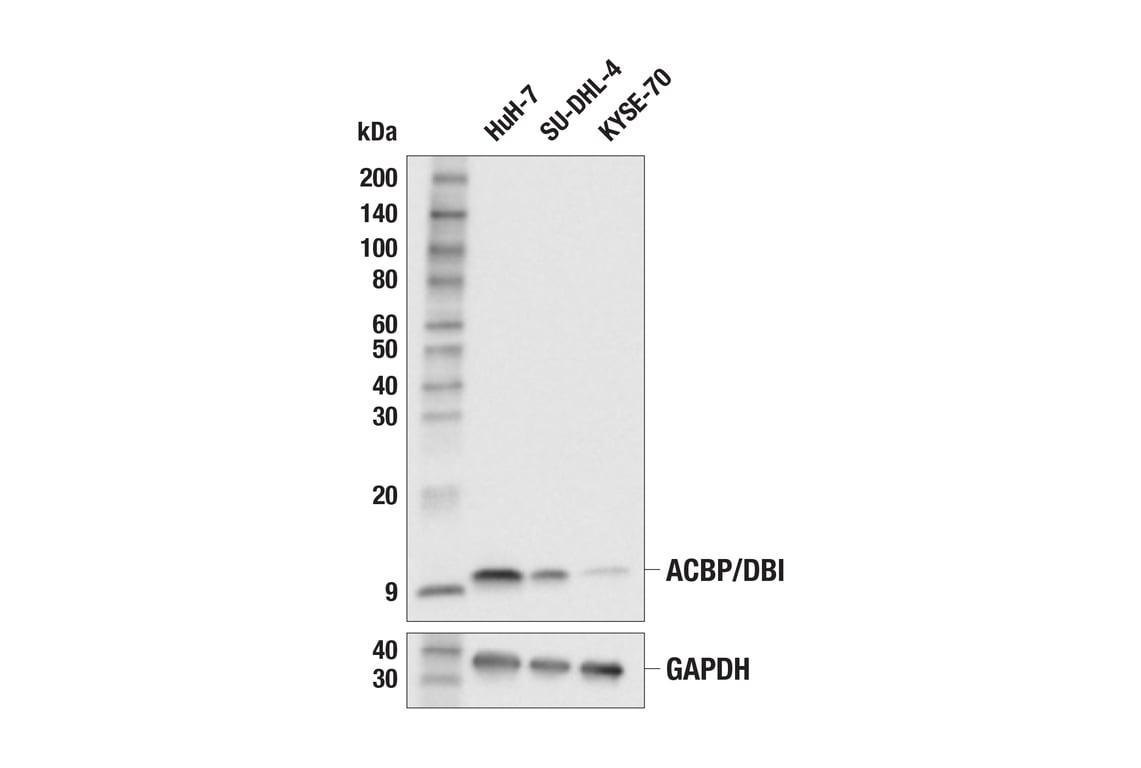 Western Blotting Image 1: ACBP/DBI (E4V8V) XP<sup>®</sup> Rabbit mAb