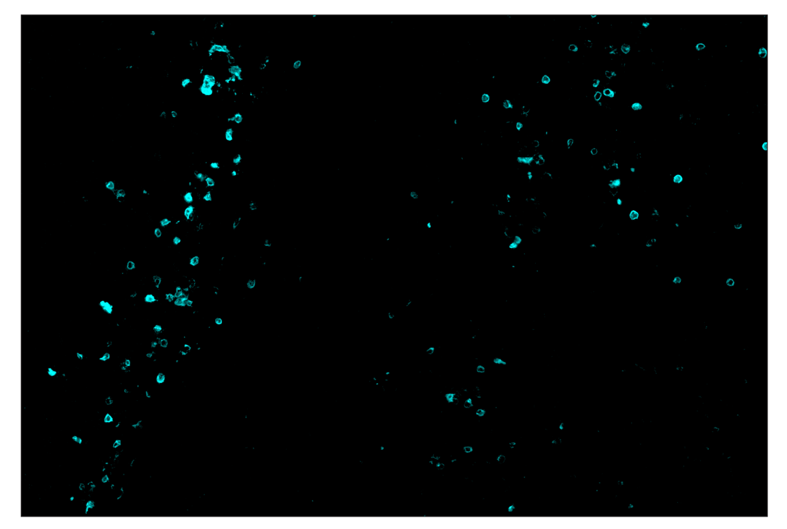 Immunohistochemistry Image 5: IL-2Rα/CD25 (E9W2J) & CO-0074-488 SignalStar<sup>™</sup> Oligo-Antibody Pair