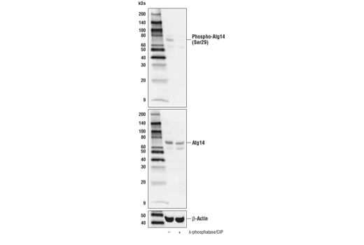 undefined Image 26: ULK1 Substrate Antibody Sampler Kit