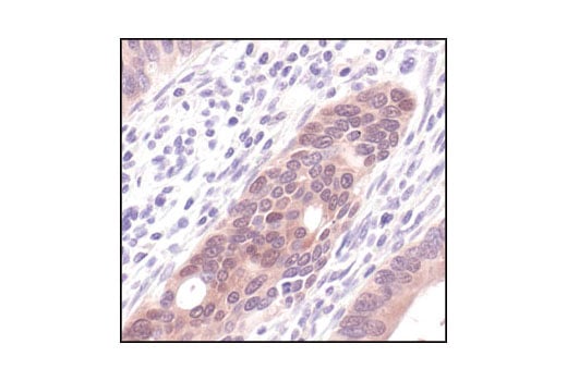 Immunohistochemistry Image 1: Phospho-4E-BP1 (Thr37/46) (236B4) Rabbit mAb