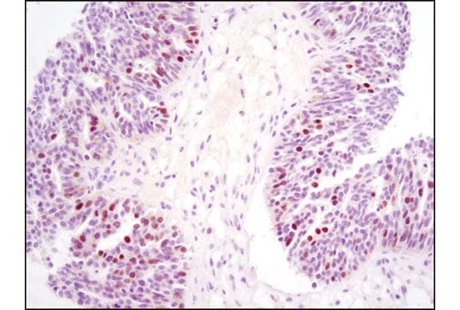 Immunohistochemistry Image 3: Skp2 (D3G5) XP<sup>®</sup> Rabbit mAb