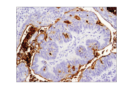 Immunohistochemistry Image 3: MUC1-C (D5K9I) XP<sup>®</sup> Rabbit mAb (BSA and Azide Free)