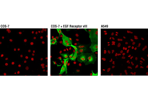 Immunofluorescence Image 1: EGF Receptor vIII (D6T2Q) XP<sup>®</sup> Rabbit mAb (BSA and Azide Free)