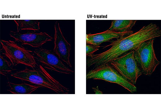 Immunofluorescence Image 1: Phospho-MKK3 (Ser189)/MKK6 (Ser207) (D8E9) Rabbit mAb