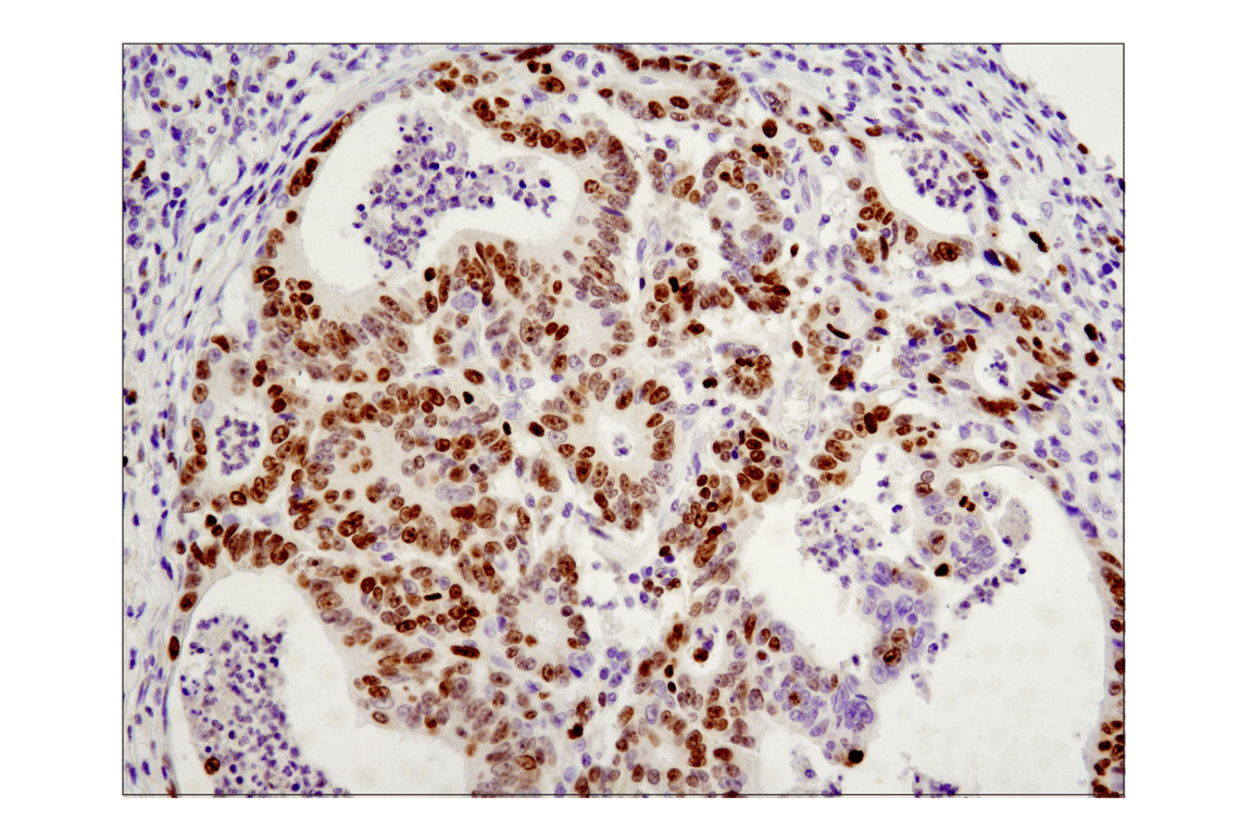 Immunohistochemistry Image 2: Ki-67 (D2H10) Rabbit mAb (BSA and Azide Free)